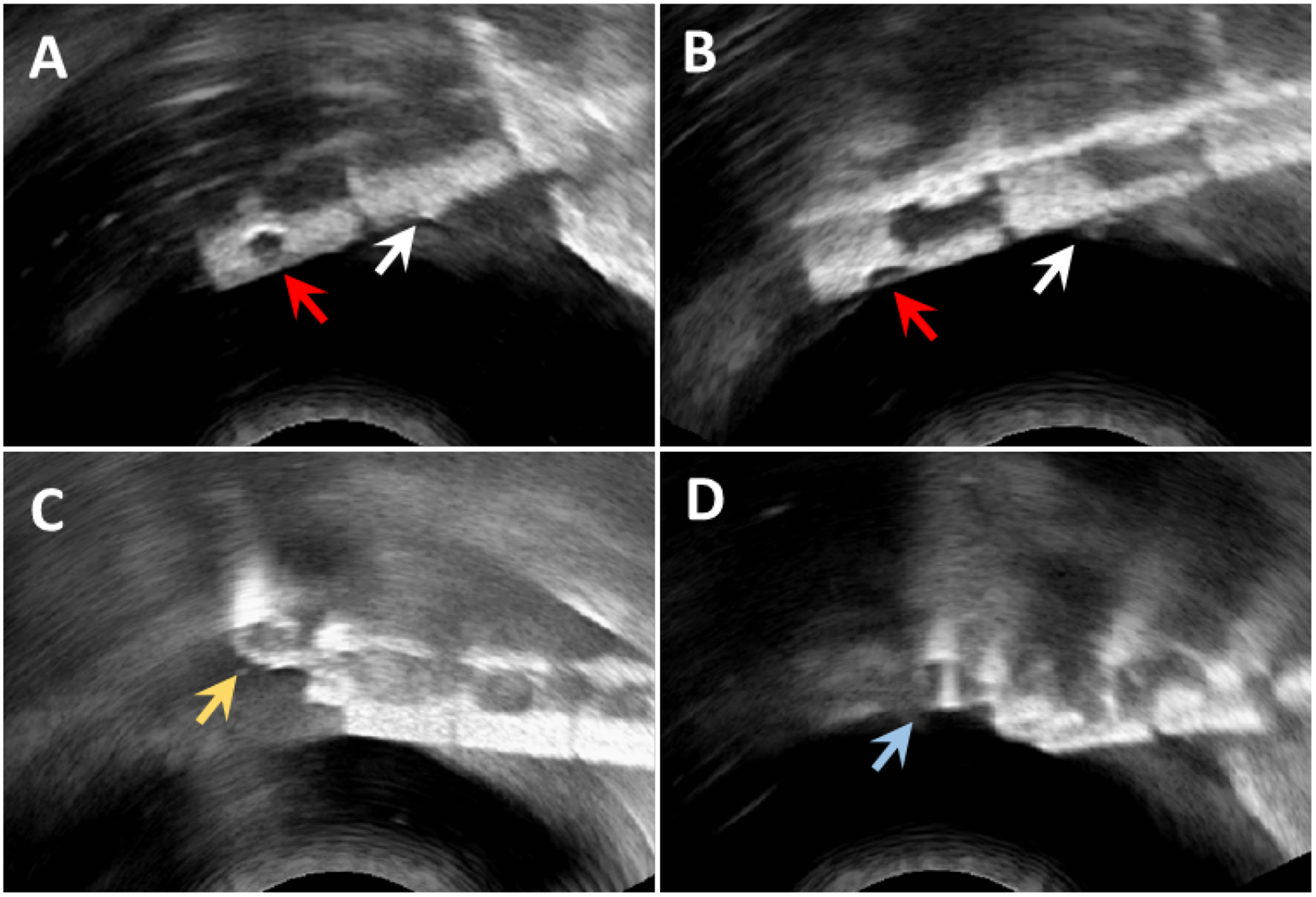 Figure 7: