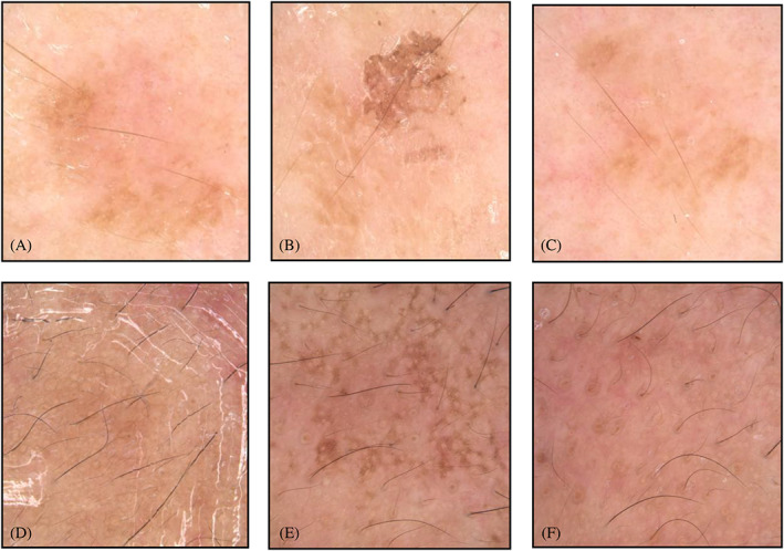FIGURE 4