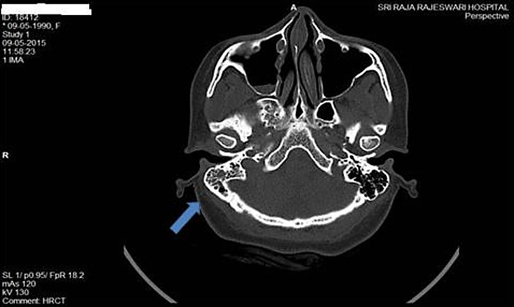 Fig. 2