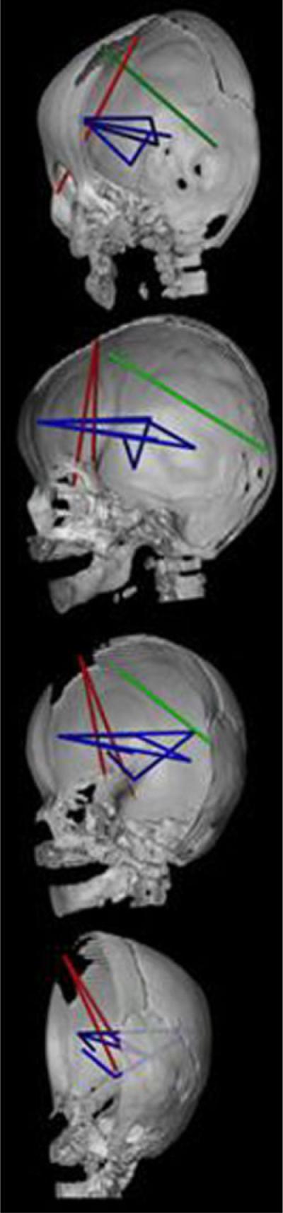 Fig. 10