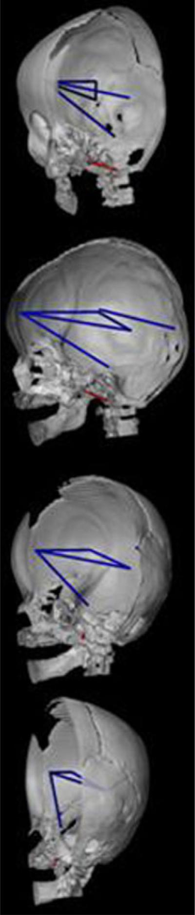 Fig. 9