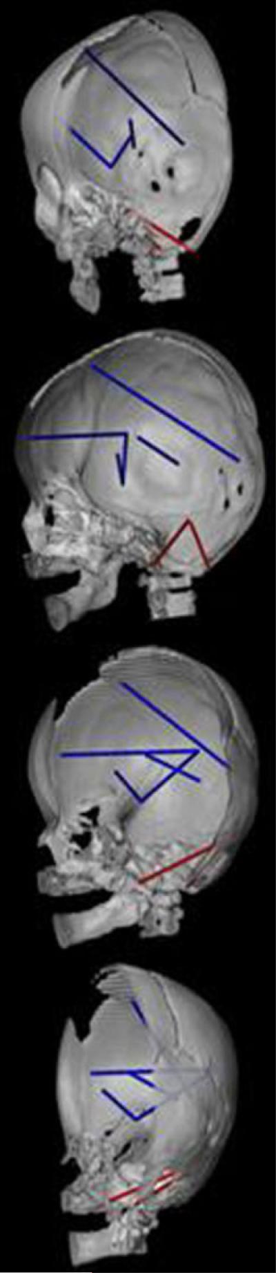 Fig. 8