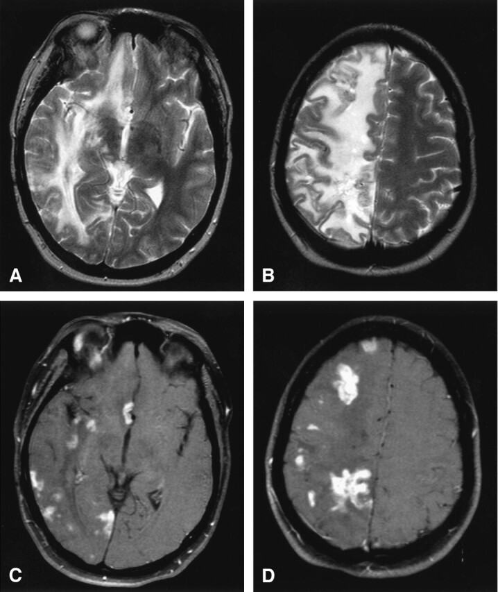 Fig 1.