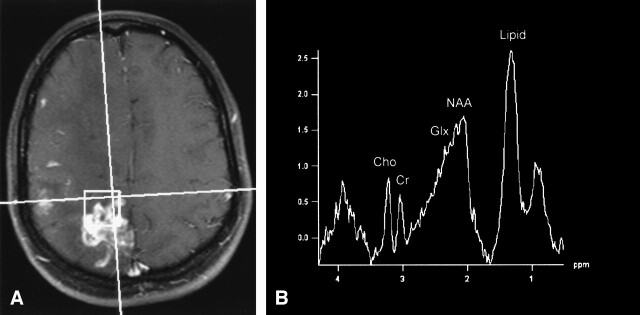 Fig 2.