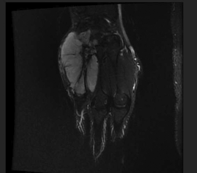 Fig. 2
