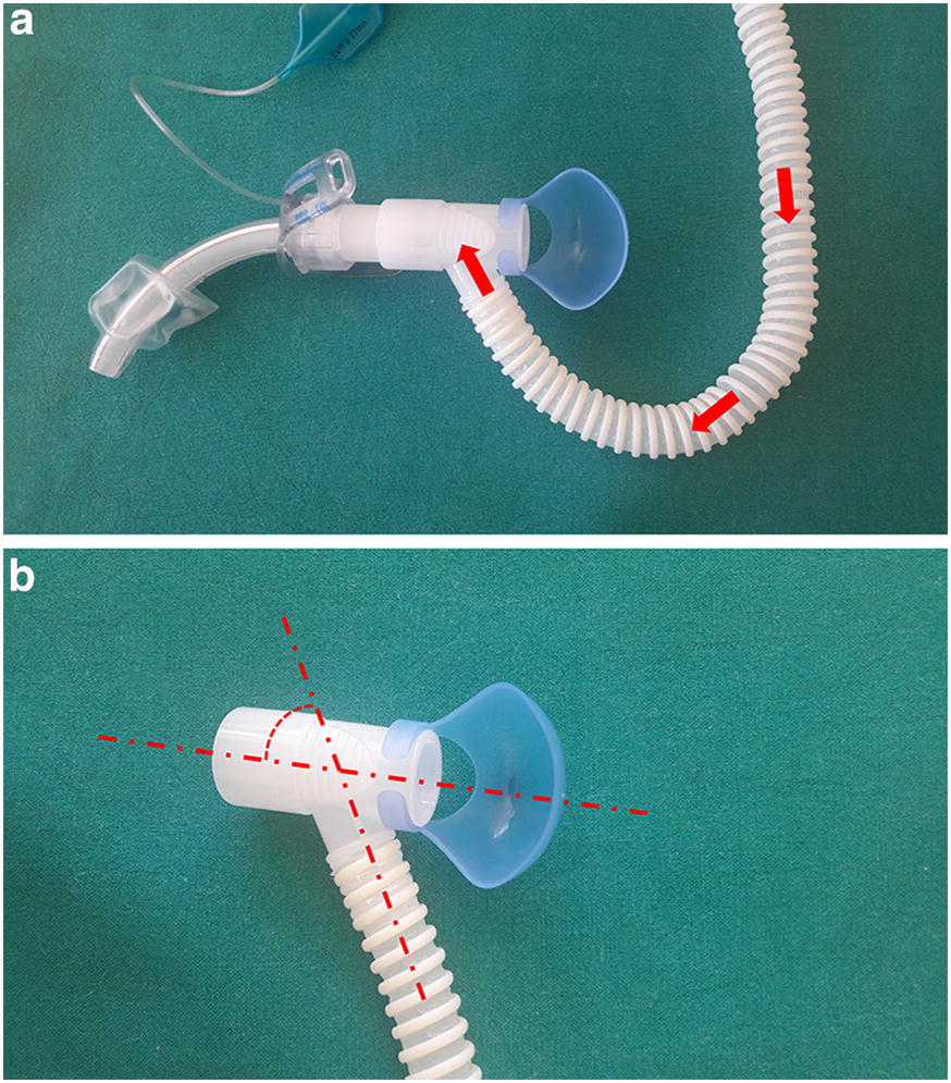 Fig. 2