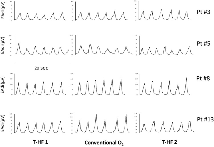 Fig. 4