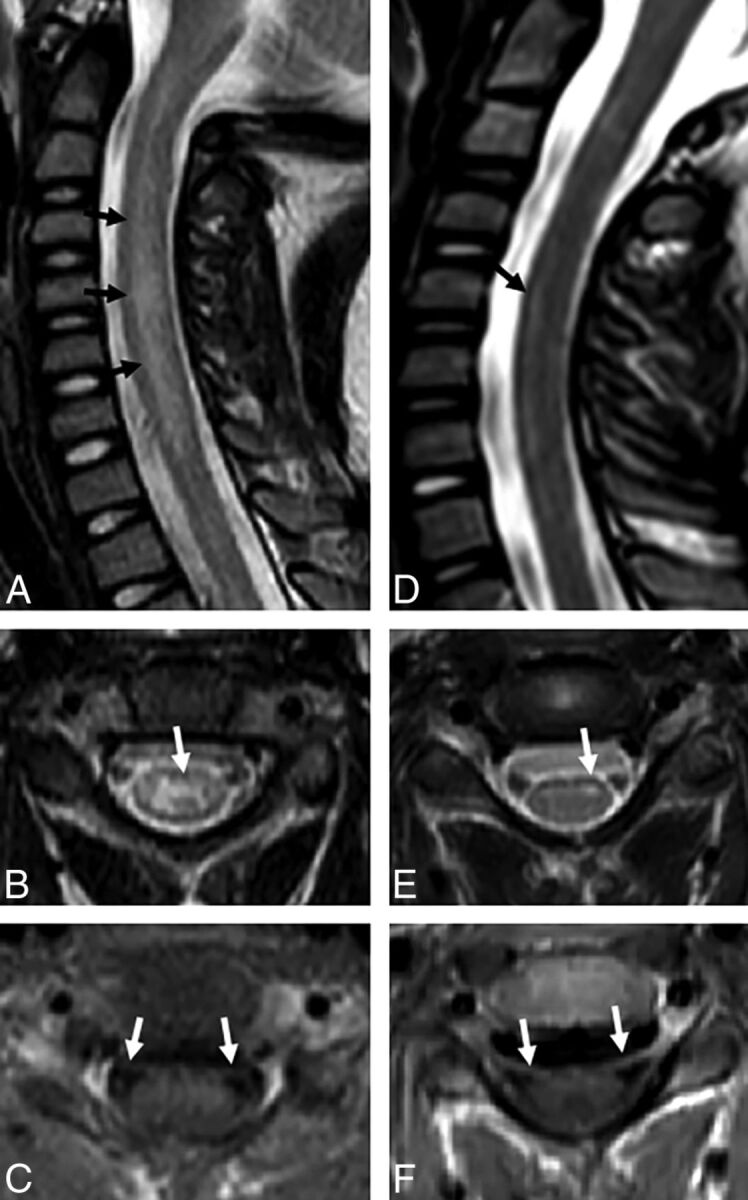 Fig 3.