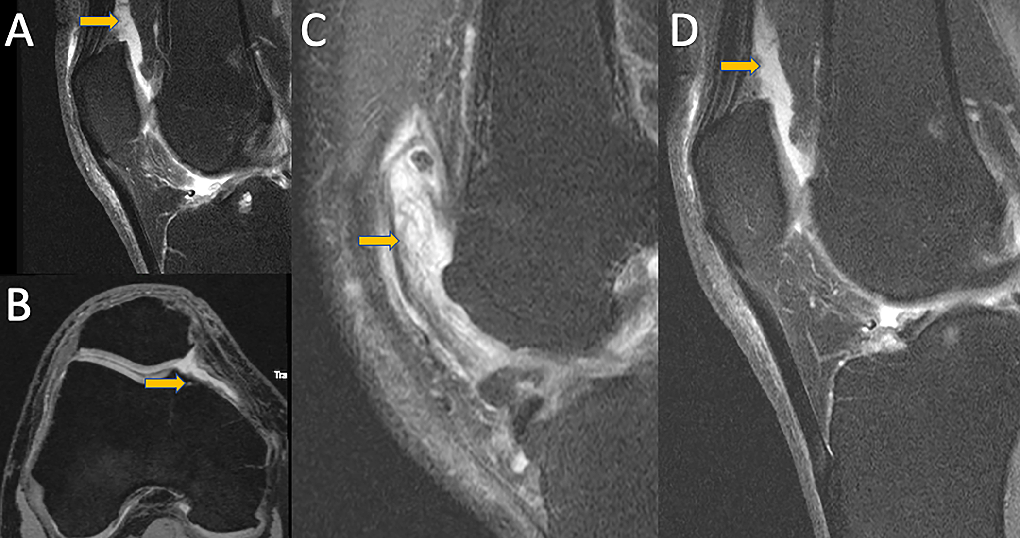 Figure 4: