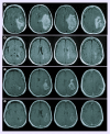 <b>Figure 1.</b>