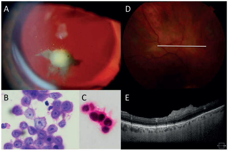 Figure 2: