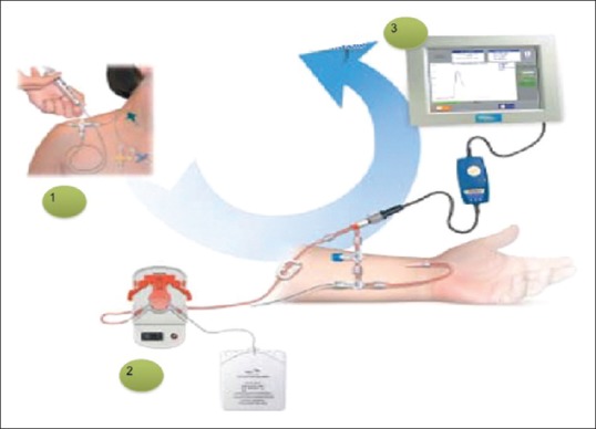 Figure 4