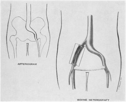 Fig. 2a.