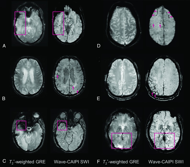 Fig 1.