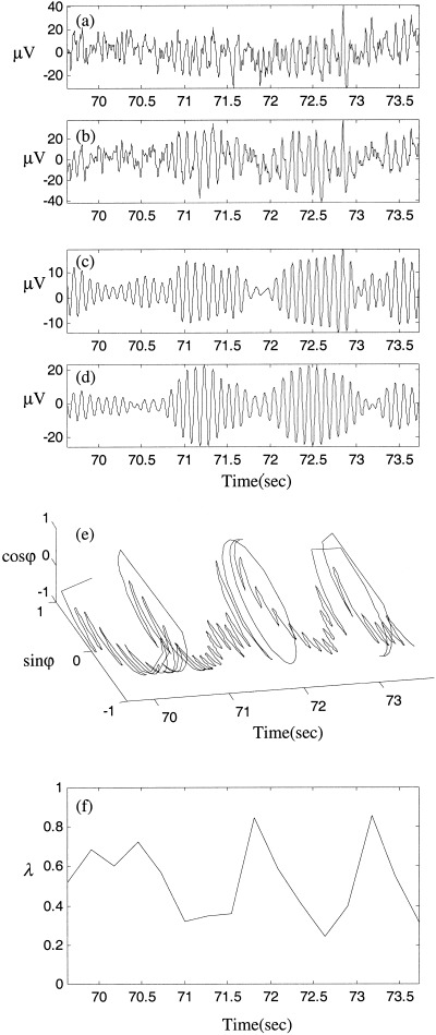 Figure 15