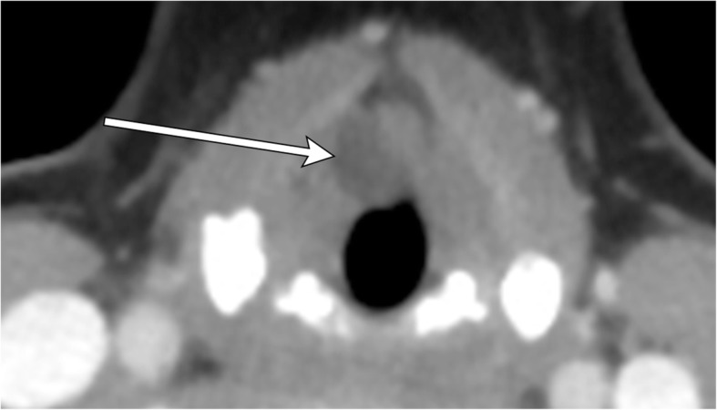 Fig. 15