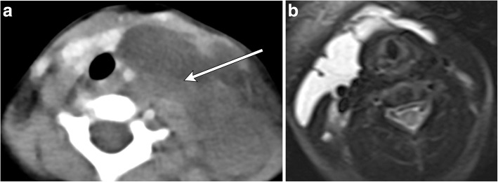 Fig. 18