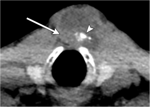 Fig. 11