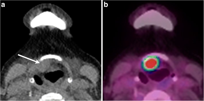 Fig. 12