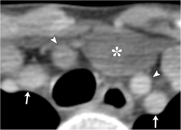 Fig. 16