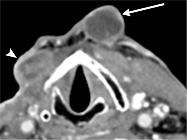 Fig. 17