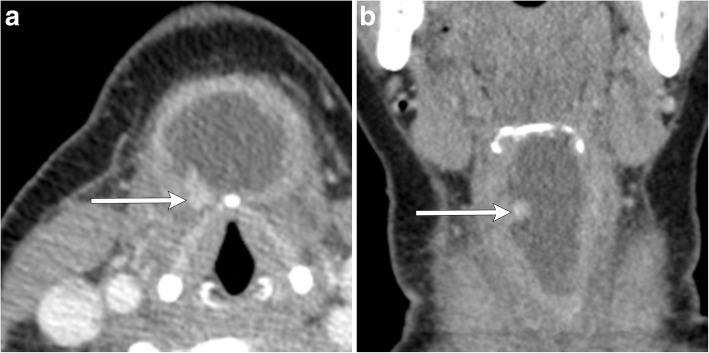 Fig. 10