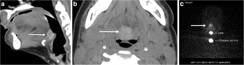 Fig. 20