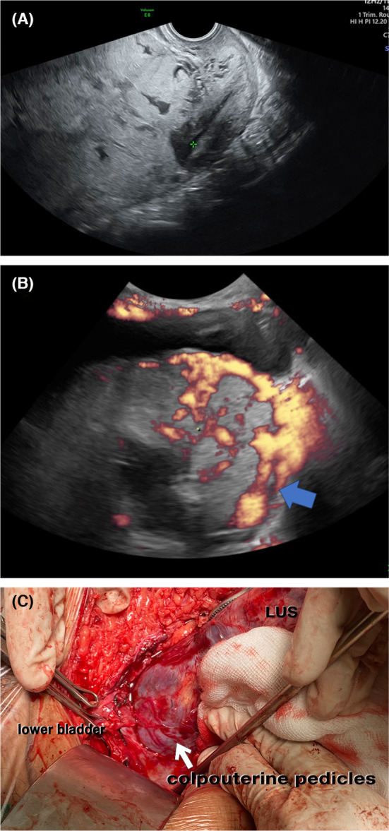 FIGURE 3