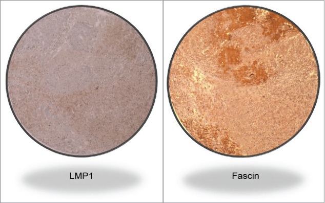 Figure 1B.