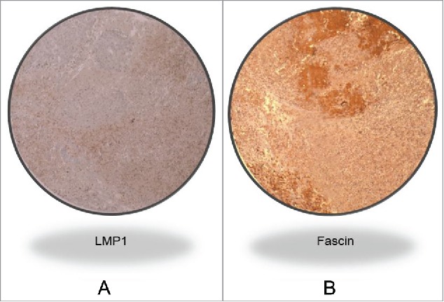 Figure 1A.