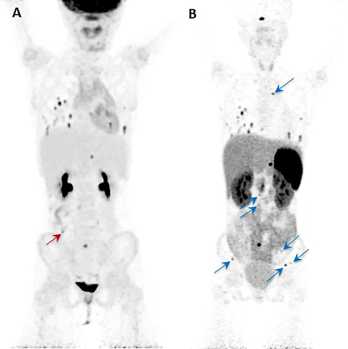 Figure 2