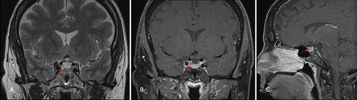 FIG. 1.