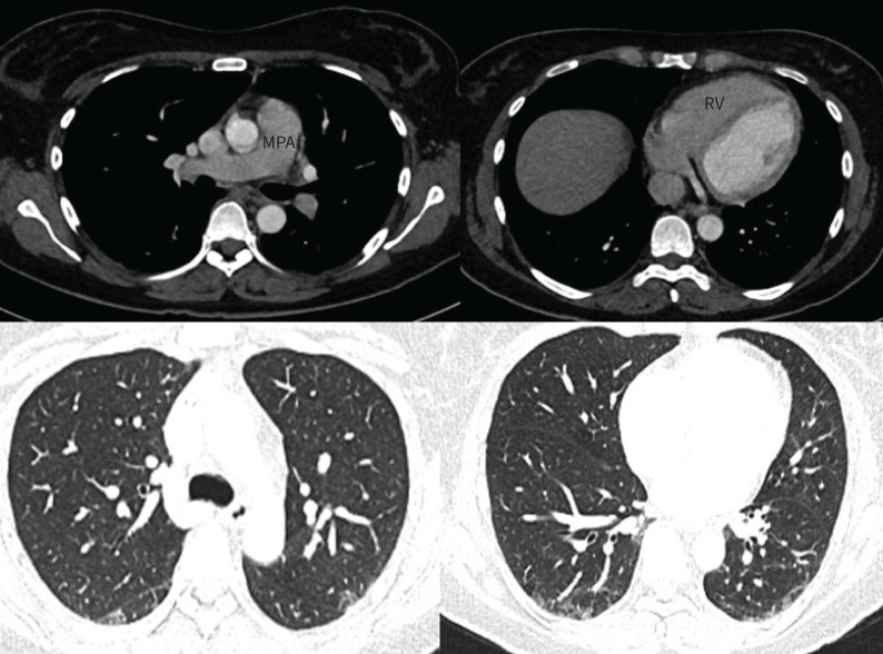 FIGURE 10