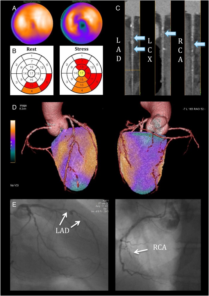 Figure 3