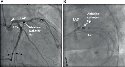 Figure 2: