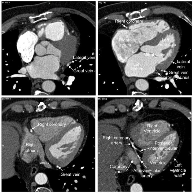 Fig. 2