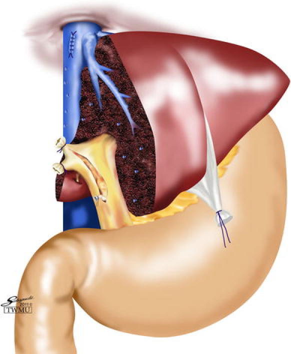 Fig. 7