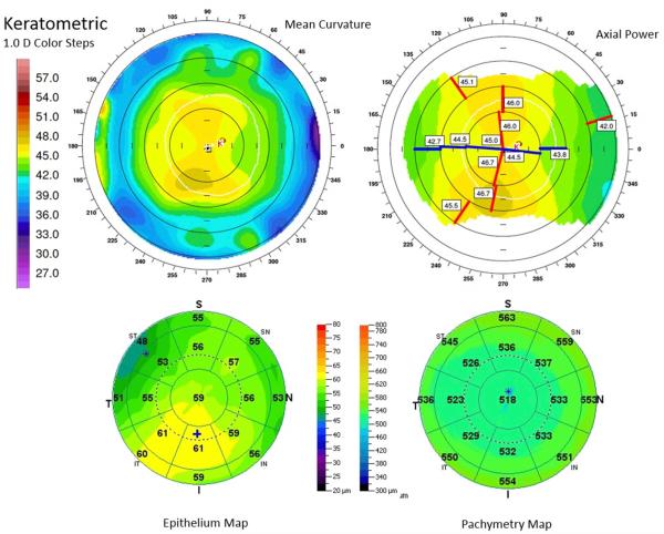 Figure 4