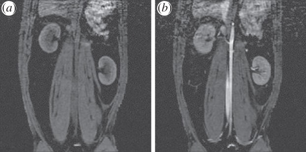 Figure 11.