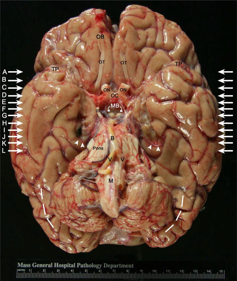 FIGURE 2