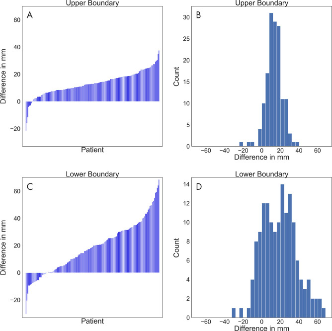 A, C, Waterfall plots and, B, C, histograms show the differences between the software-generated scan ranges and the ground truth scan ranges for each patient. A positive difference indicates that the generated scan range was longer. A, The differences at the upper boundary were sorted and plotted as bars. B, The differences at the upper boundary were plotted by counts with a bin width of 2 mm. C, The differences at the lower boundary were sorted and plotted as bars. D, The differences at the lower boundary were plotted by counts with a bin width of 2 mm.