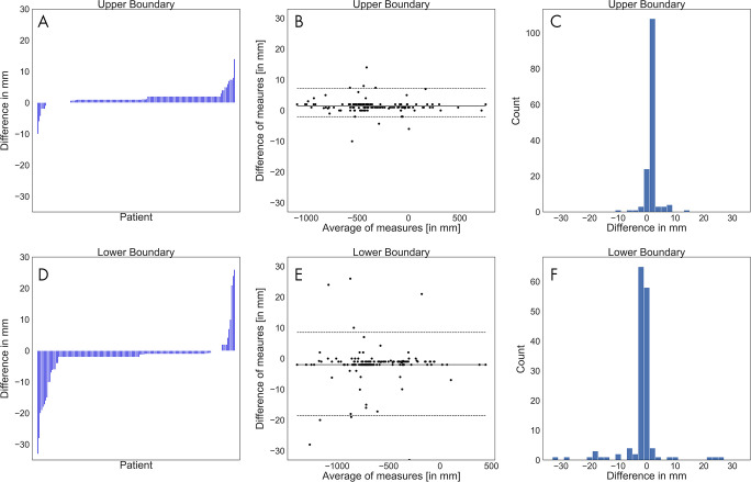 A, D, Waterfall plots, B, E, Bland-Altman plots, and, C, F, histograms of the differences between the software-generated scan ranges and the radiologists’ scan ranges for each patient. A positive difference indicates that the radiologists’ scan range was longer. A, The differences at the upper boundary were sorted and plotted as bars. B, The average of both measurements at the upper boundary were plotted against their differences. The solid line marks the mean of differences, and the dashed lines mark the limits of agreement based on the 2.5% and 97.5% quantiles. C, The differences at the upper boundary were plotted by counts with a bin width of 2 mm. D, The differences at the lower boundary were sorted and plotted as bars. E, The average of both measurements at the lower boundary were plotted against their differences. The solid line marks the mean of differences, and the dashed lines mark the limits of agreement based on the 2.5% and 97.5% quantiles. F, The differences at the lower boundary were plotted by counts with a bin width of 2 mm.