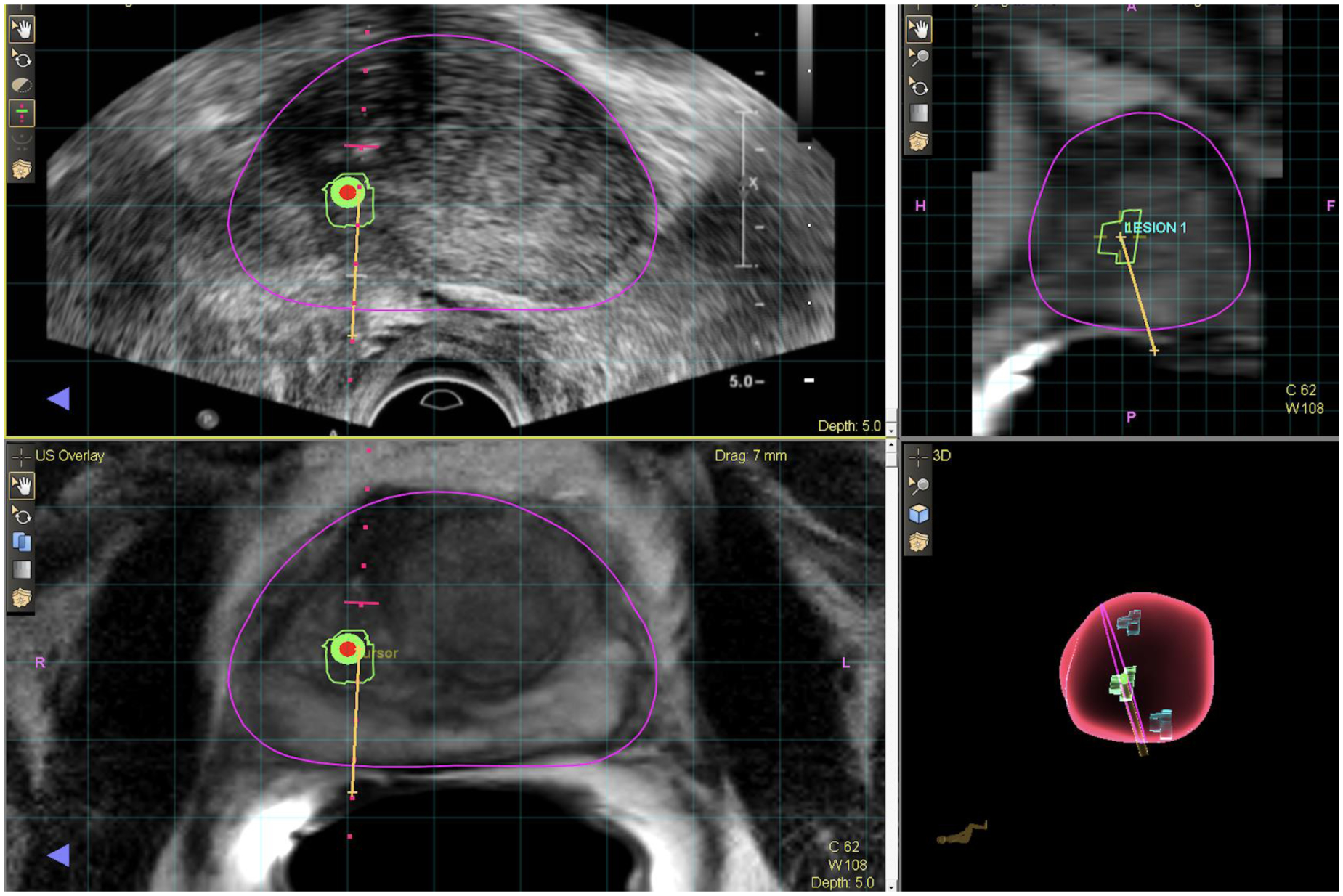 Figure 3: