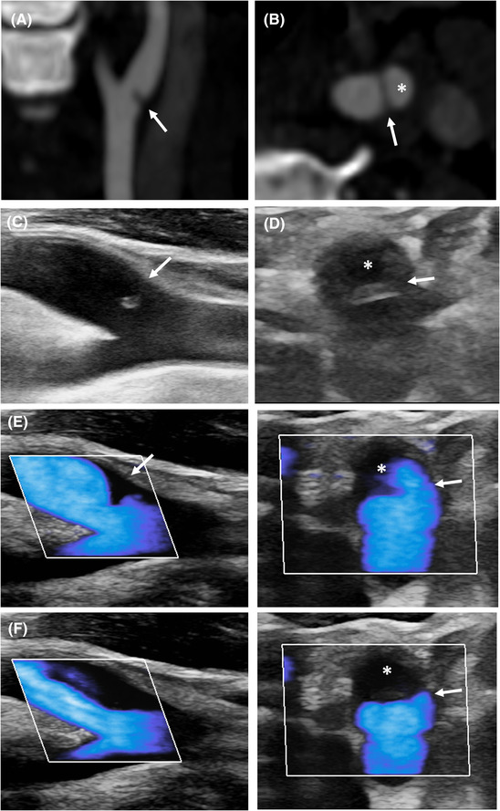 FIGURE 1