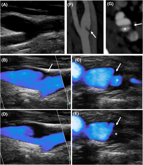 FIGURE 4