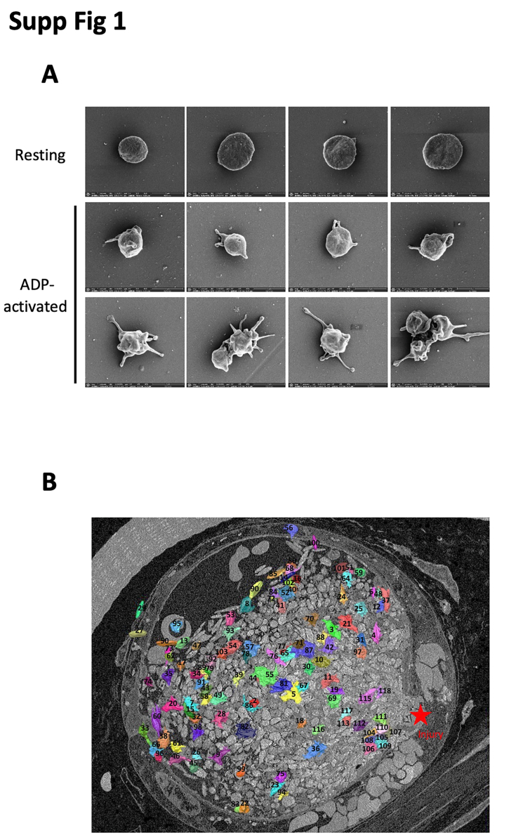 Supplementary Figure1