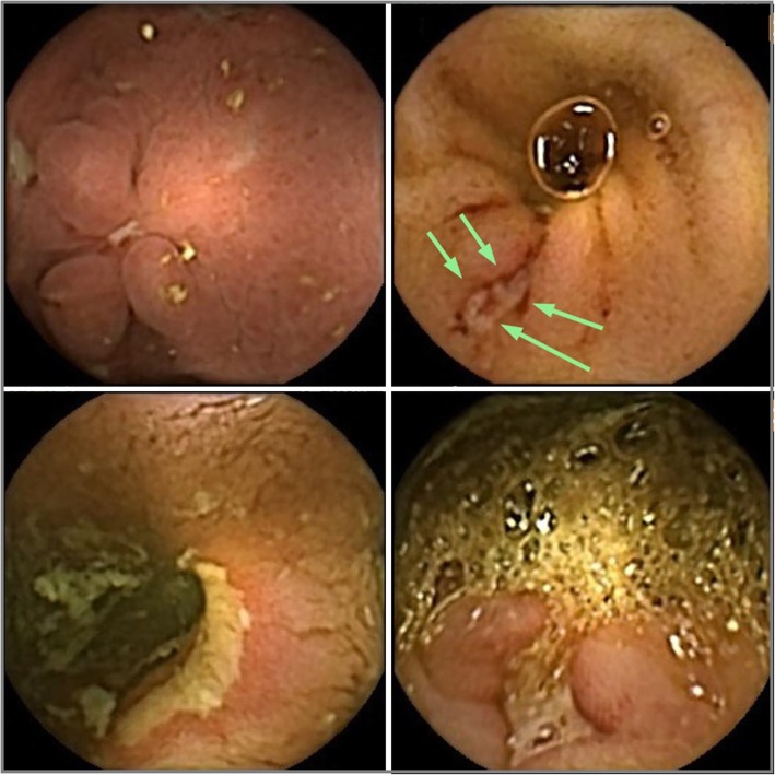 Fig. 1