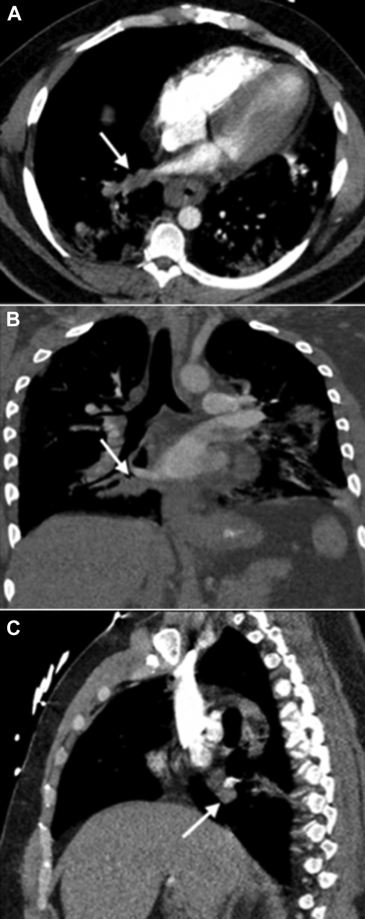 Figure 3