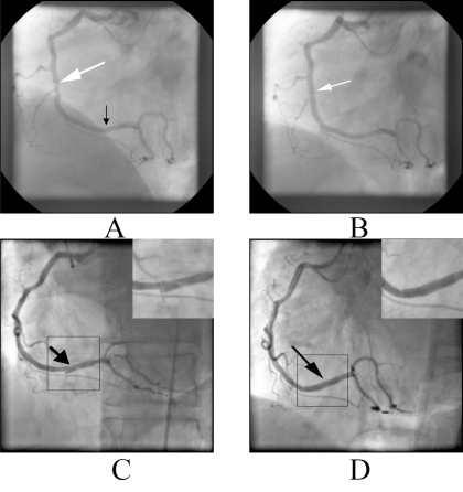 Fig. (1)