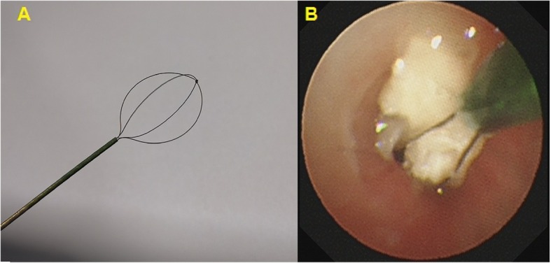 Fig. 2